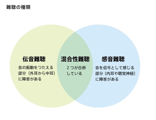 聴覚障害の基礎知識：難聴の分類、多様なコミュニケーション方法、仕事