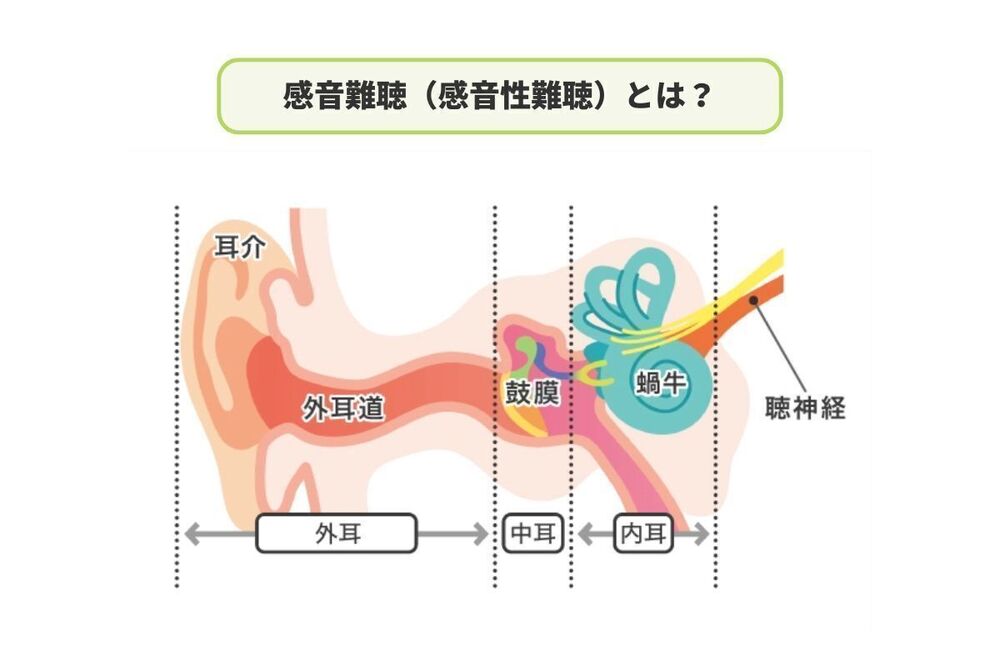 記事トップイメージ画像