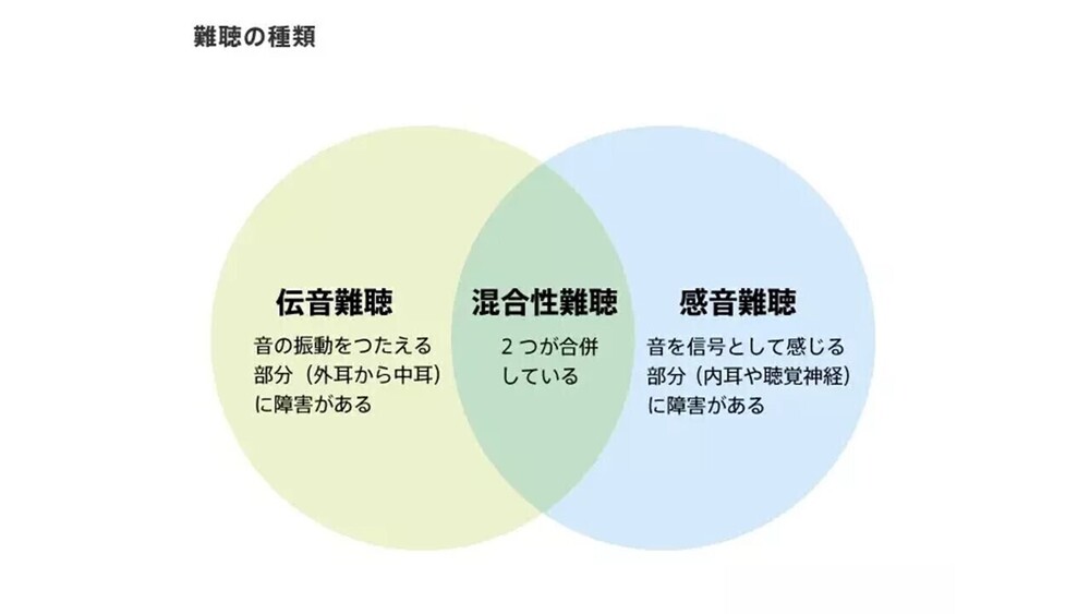 記事トップイメージ画像